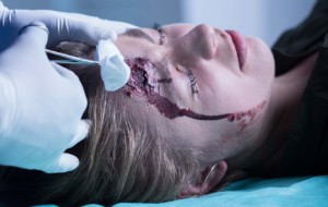  Doctor Cleaning A Wound On Womans Head